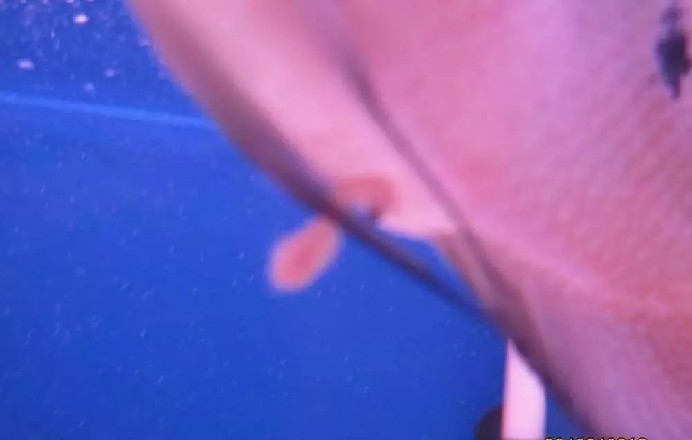 溃疡性肠炎有哪些症状如何治疗,猫胃肠炎的症状判断及治疗方法