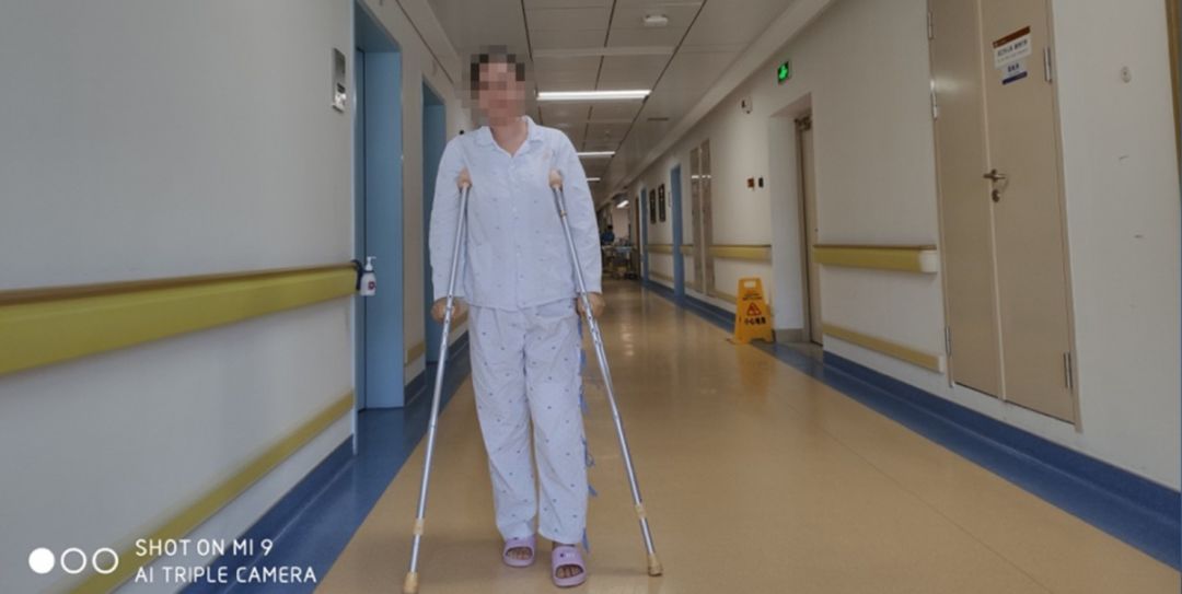 摔了一跤骨裂要做微创手术,摔一跤脚骨折手术