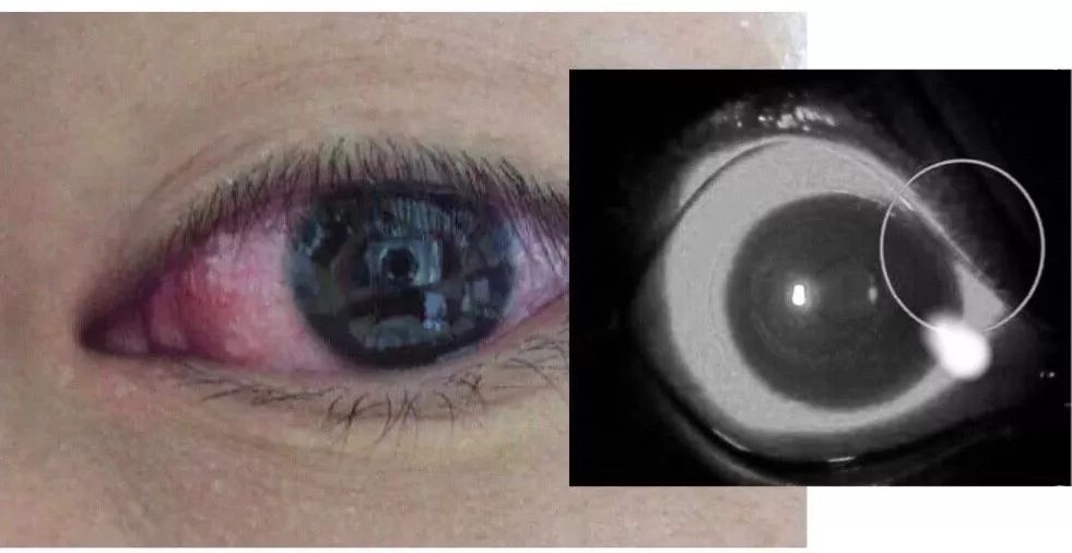 幼儿园教师疏忽导致安全事故,幼儿园疏忽管理导致孩子受伤