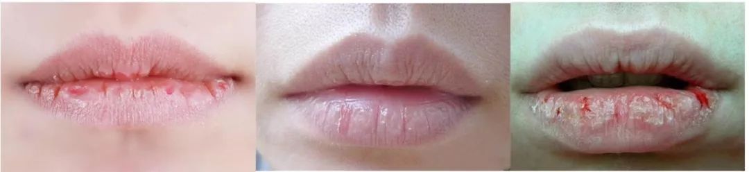 花瓣唇怎么涂唇膏,花瓣唇该如何涂口红