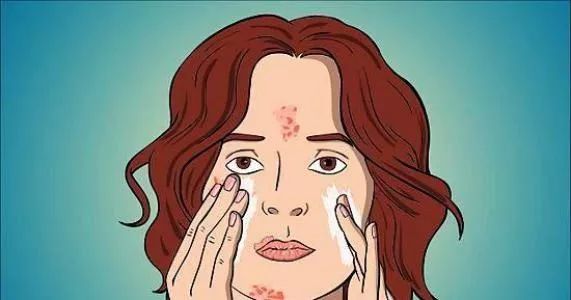 治痘痘维a酸用多少浓度的,使用维a酸爆痘要继续用吗