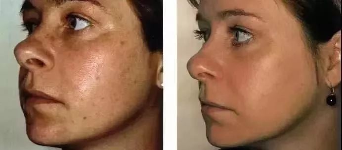 去黑头日本洗面奶,日本去角质保湿洗面奶