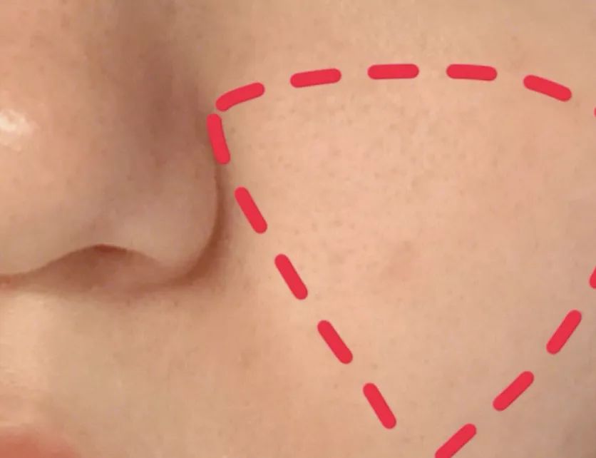 冬季干燥持久补水喷雾300ml保湿,补水喷雾巨补水秋冬