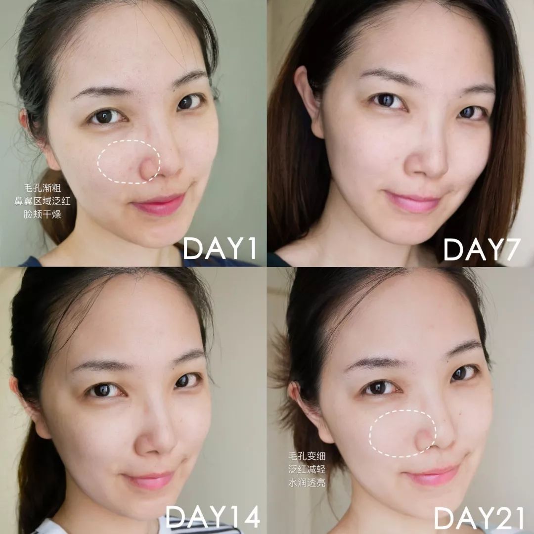 肌诊室修复,肌诊室水光肌挑战