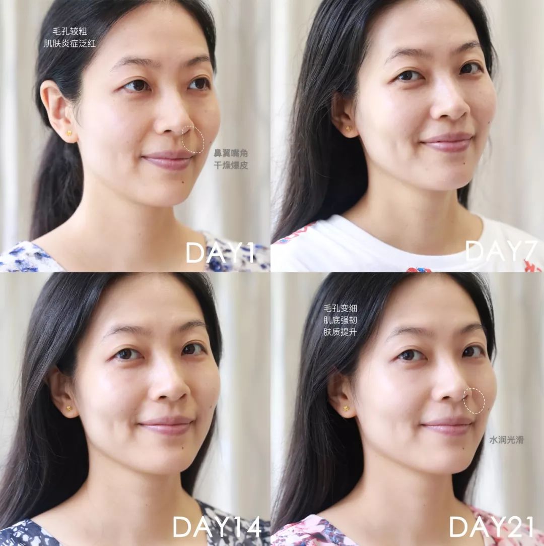 肌诊室水光肌挑战,肌诊室修复