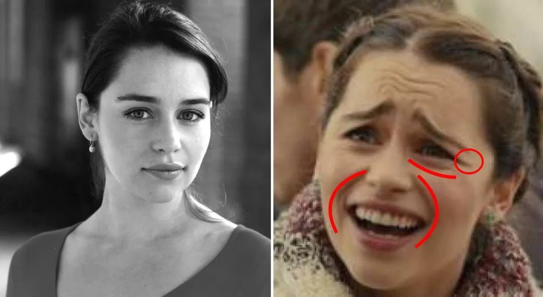 法令纹和眼纹怎么才能有效改善,法令纹贴眼贴有用吗