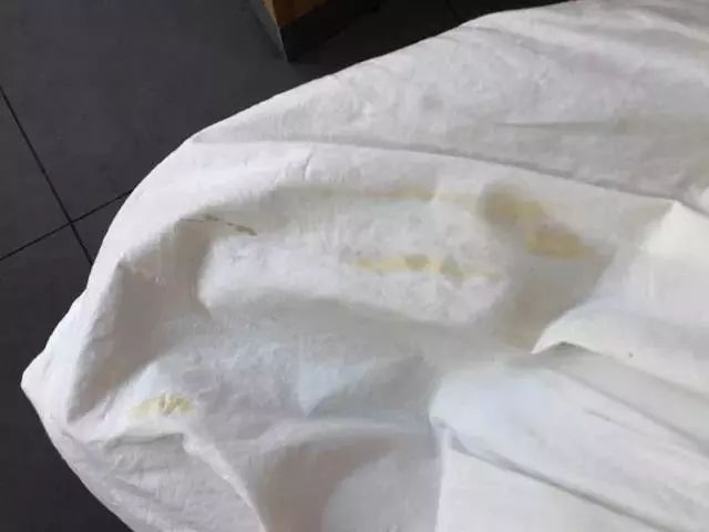 夏天来了衣服上潮湿有霉斑怎么办,长了霉斑的衣服怎么洗