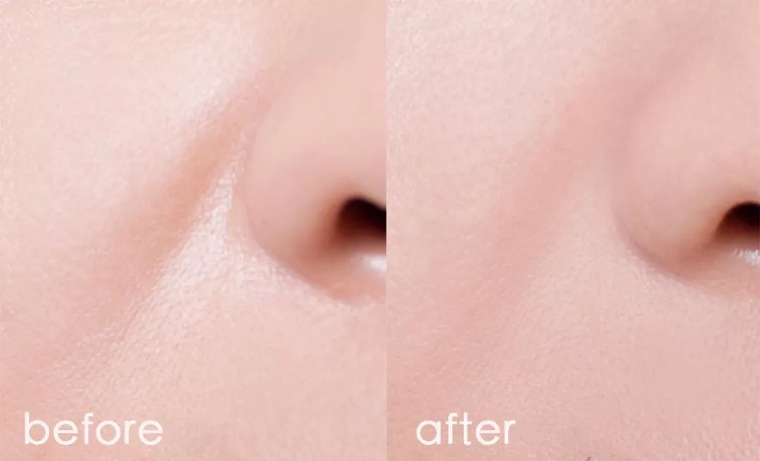 对抗岁月魔皱，护肤品能做的比你想象中更多...