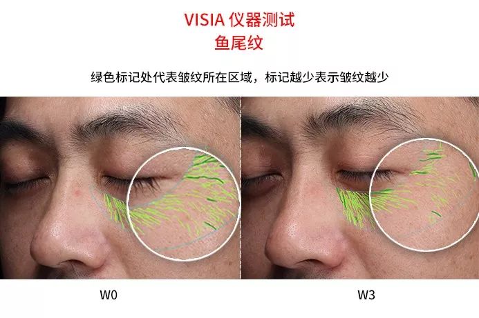 同样的年龄有的年轻人有的人老,同样的年龄为何他却比你显得年轻