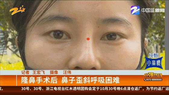 鼻子歪了呼吸不畅怎么办,鼻子骨头歪了呼吸不顺畅怎么办