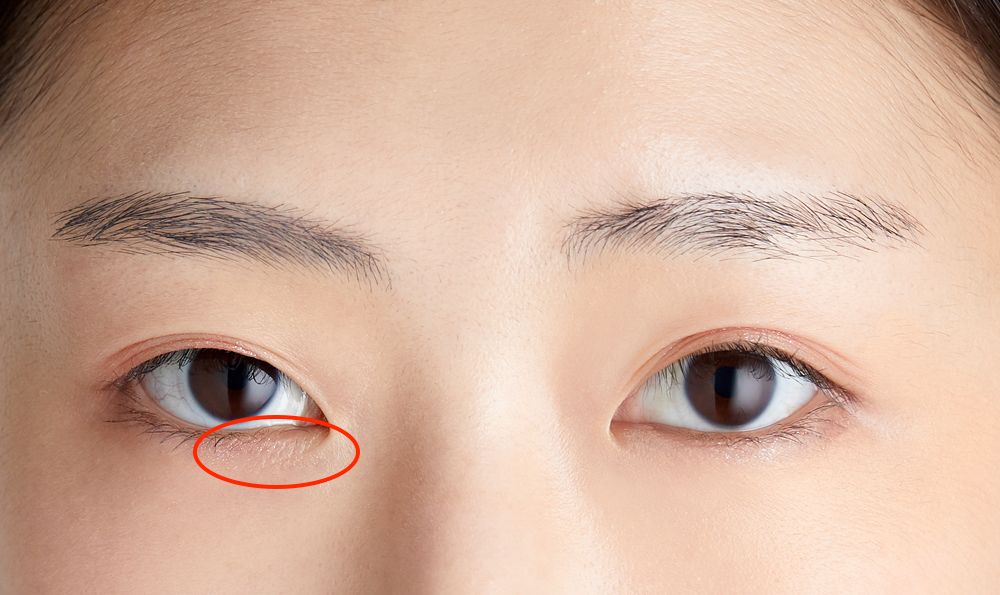 一款超值眼霜,一支2000元的眼霜能治眼袋