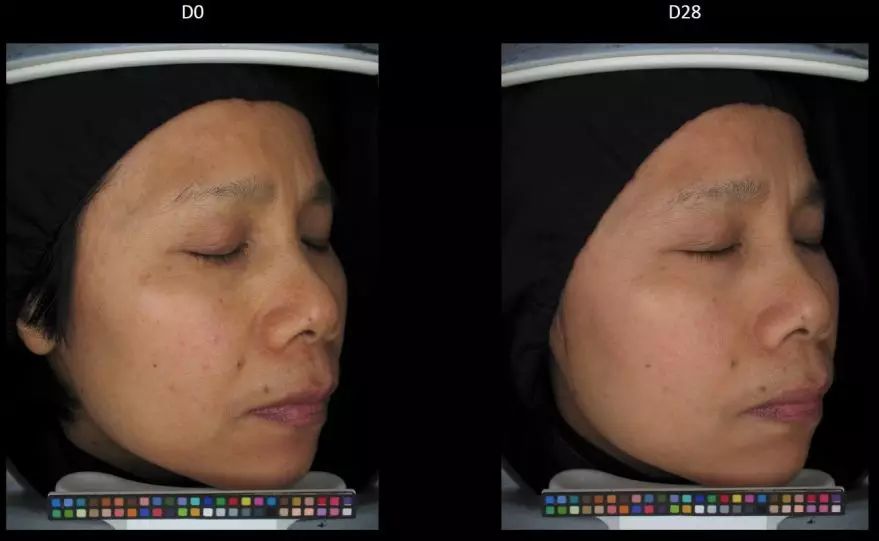 变白的视频教程,真正变白小技巧