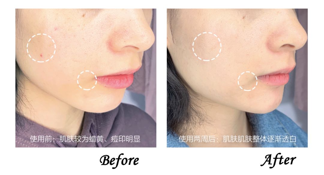 我的双11购物必买清单,双11购物车推荐