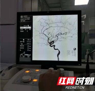 湖南脑血管造影,娄底市第二人民医院内科专家