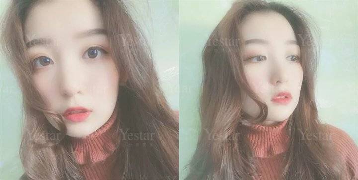 十大骗局肉毒素药,微整形注射假药案例