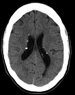 神经影像,神经影像解剖图