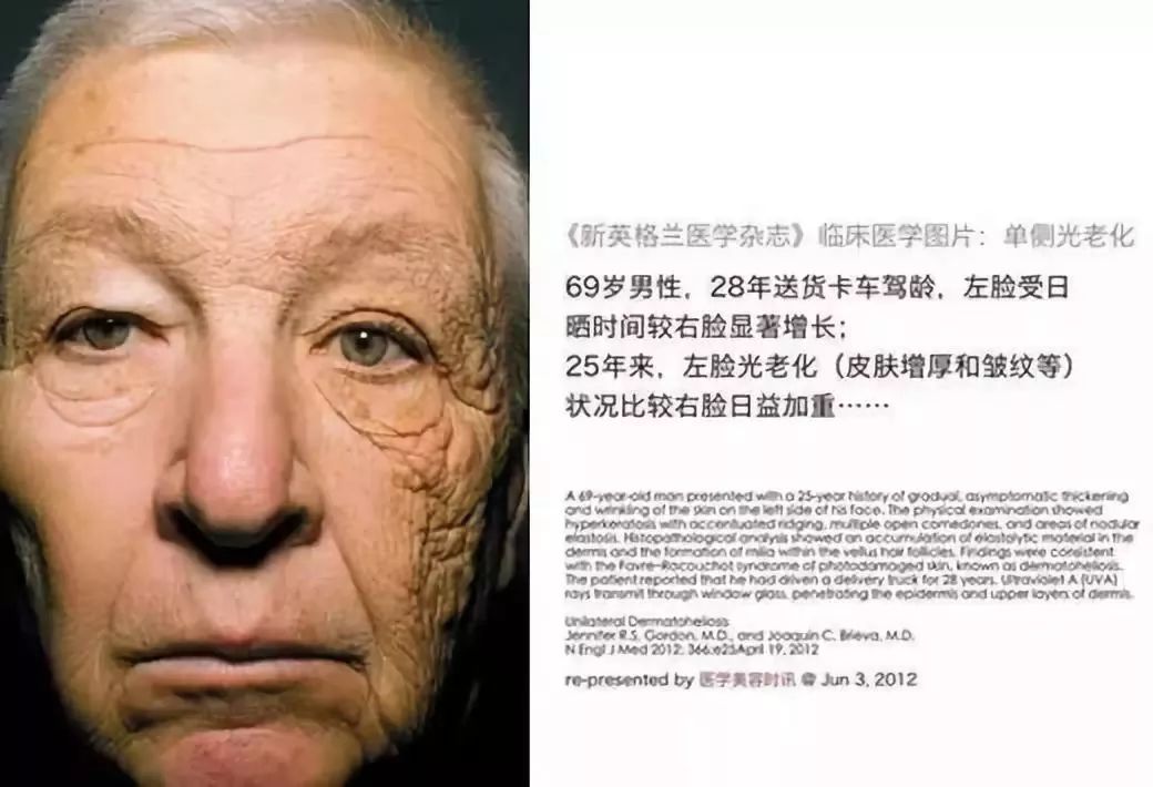 有没有什么方法变白一点,真正有效变白的护肤品