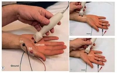 指尖发麻有针刺感看什么科室,左手拇指食指发麻针灸怎么治疗