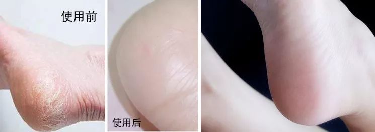 日本人吃饭都不穿鞋，熏死人了！这双耗时3年的黑科技银离子袜，美白润肤自发热，穿7天都不臭脚