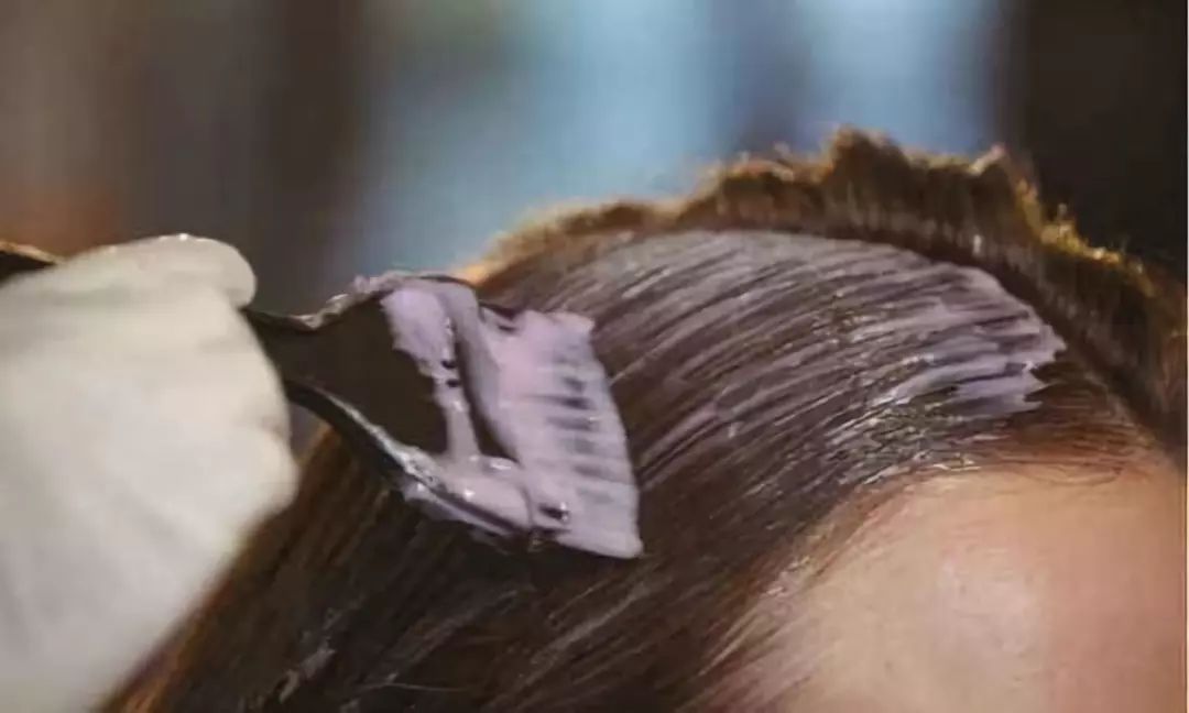 「小心」眼睛肿成缝，头皮溃烂…一周接诊20多例！当心，年前很多人爱做这事