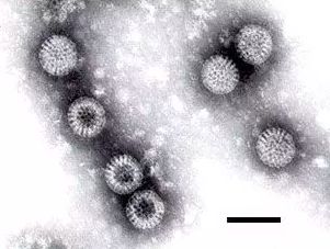 2岁轮状病毒上吐下泻怎样治疗,轮状病毒引起上吐下泻