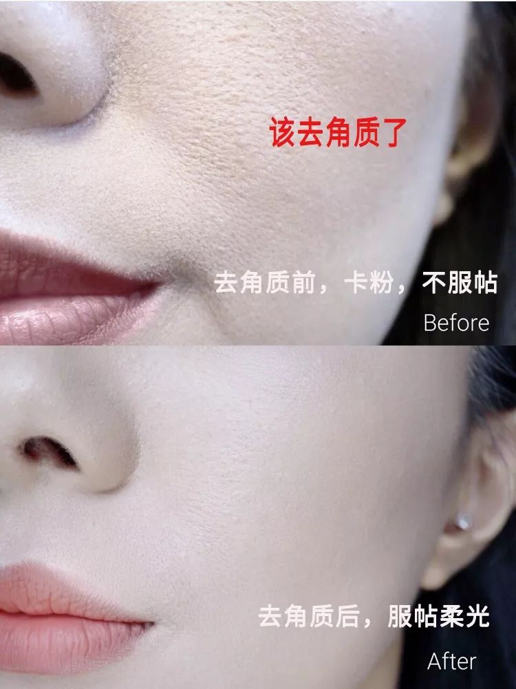 脸上搓下来很多泥,脸上搓出黑头