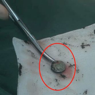 女孩肚子痛还流血,走路都不对劲了