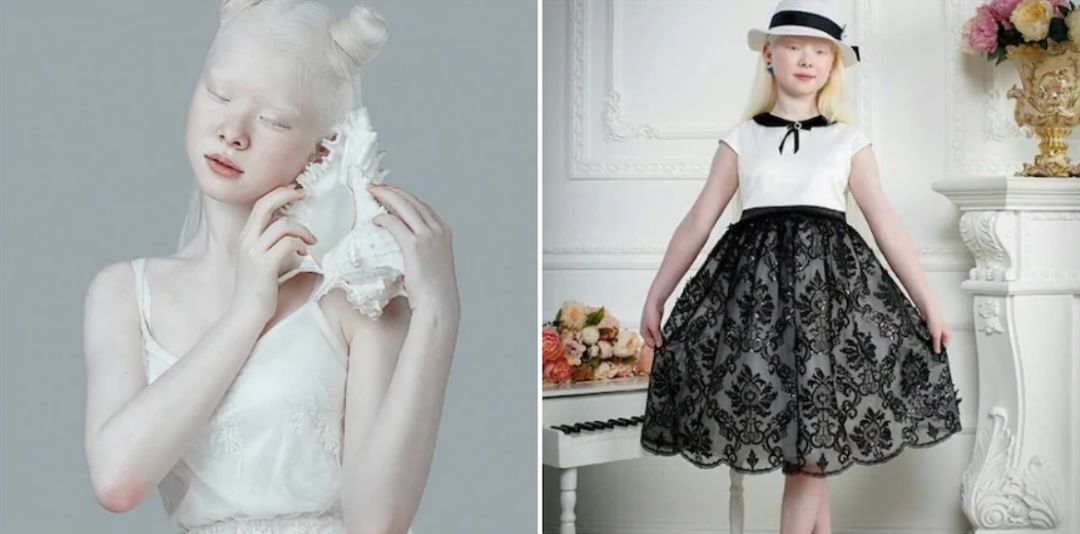 “白化病姐妹”逆袭时尚界；MAC“砸”故宫招牌？阿里“无隐私”大厦...「设计烩报296期」