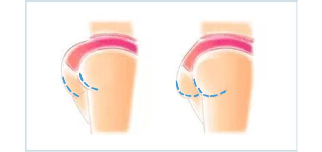 食物瘦身法大全,一周紧急瘦身法食谱