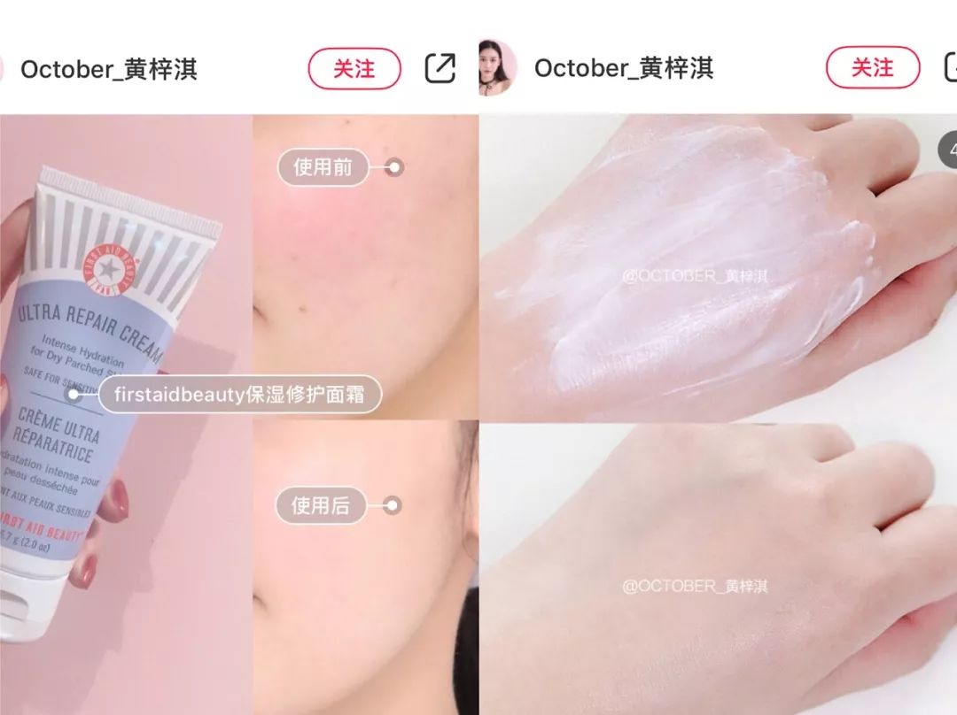 油皮敏感肌适合什么面霜,油皮敏感肌面霜推荐