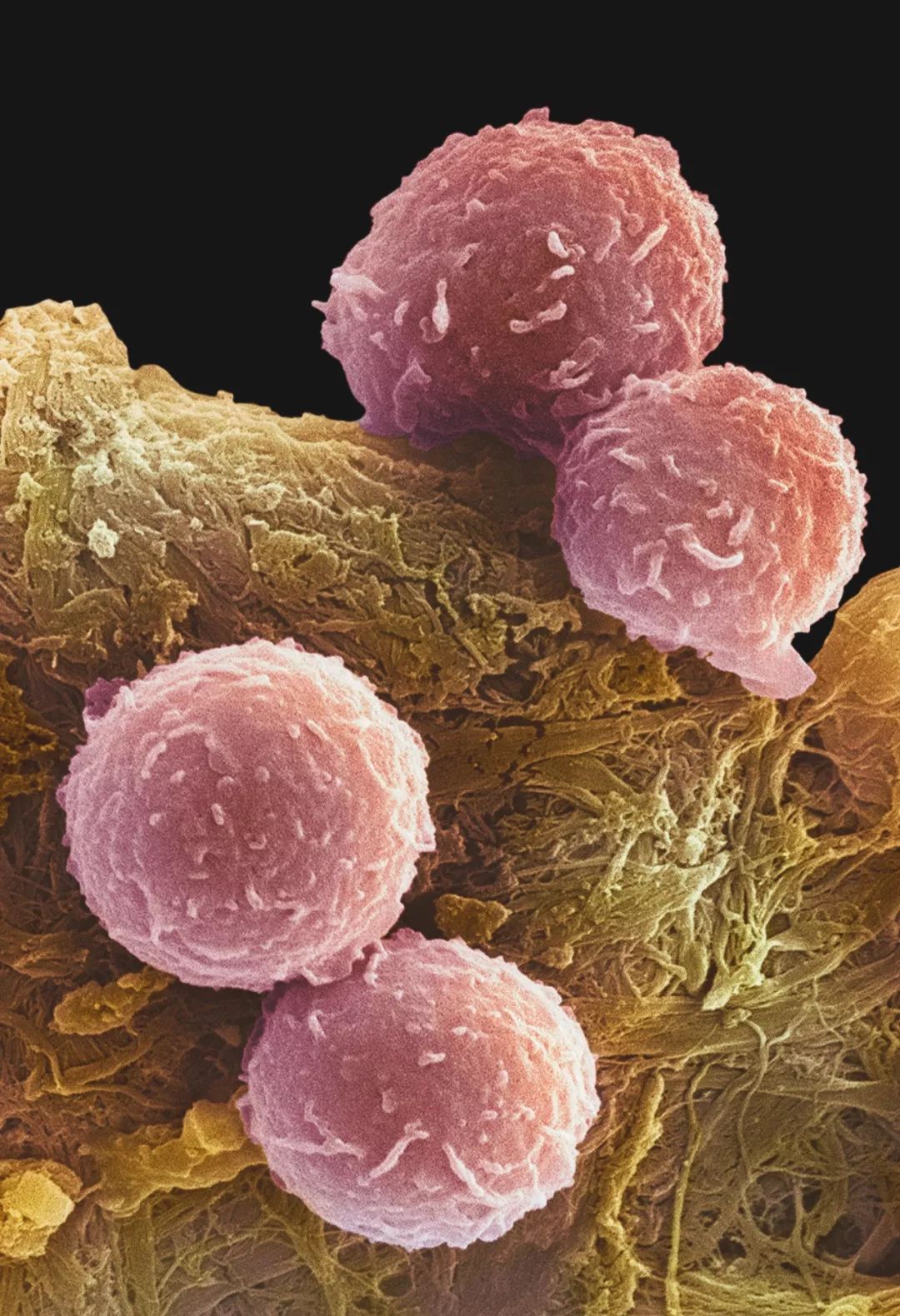 鍋囧鐥呮瘨鎰熸煋浜嗕綘,鍋囧鐥呮瘨鎰熸煋浜嗘垜