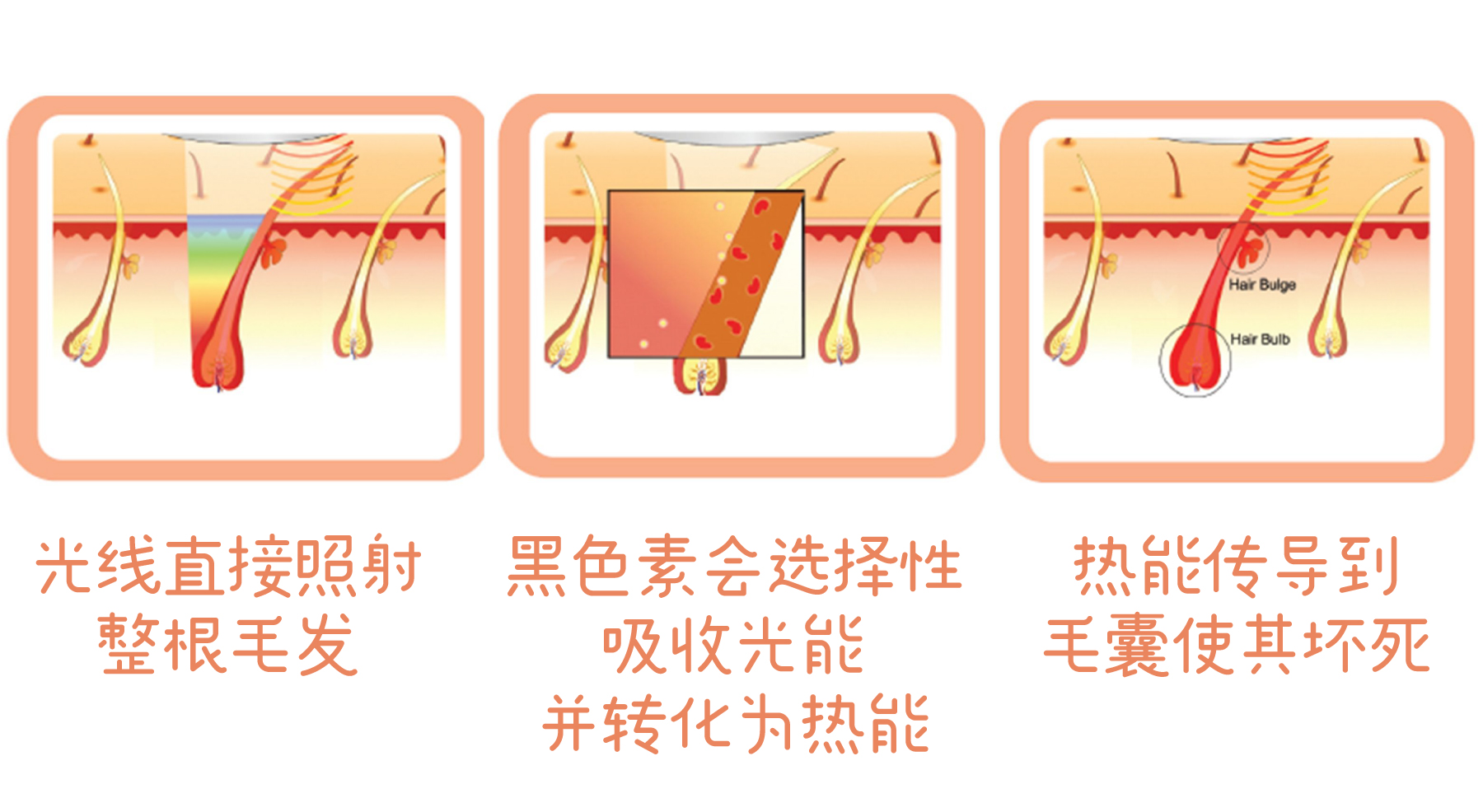 居家脱毛仪的推荐,家用脱毛仪哪一款光波最深