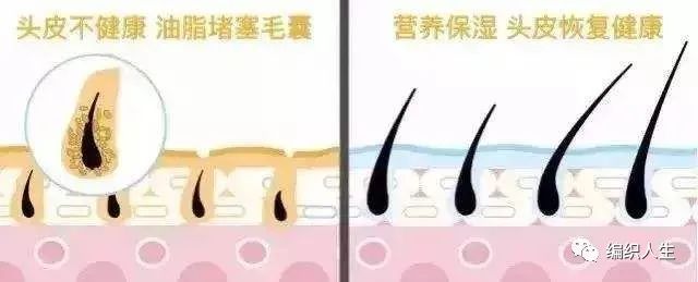 德国老太太用什么洗发水,93岁德国老太太