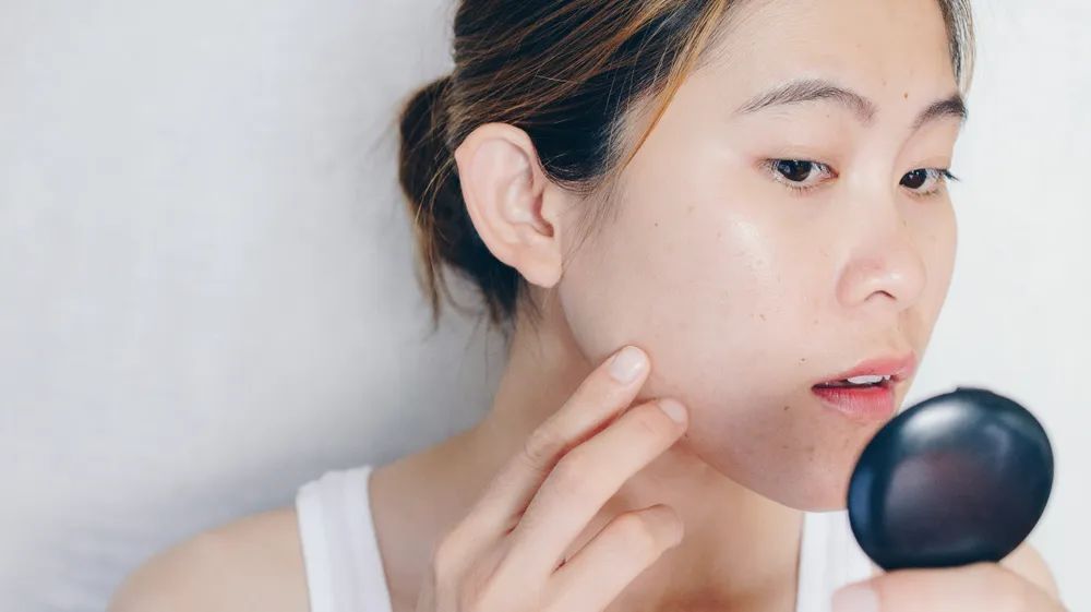 医美祛痘印一般多少钱,祛痘印做什么医美项目