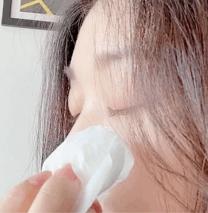 戴口罩脸上长闭口粉刺怎么办,戴口罩鼻子起痘长闭口