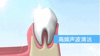 飞利浦和usmile电动牙刷哪个更好,飞利浦电动牙刷性价比高的一款