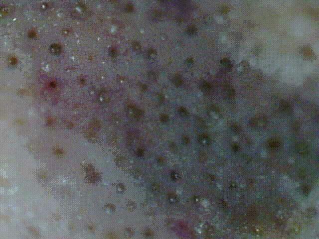 10鍒嗛挓娓呴櫎榛戝ご绮夊埡,榛戝ご绮夊埡鎸ゅ帇娓呯悊姣涘瓟绮楀ぇ