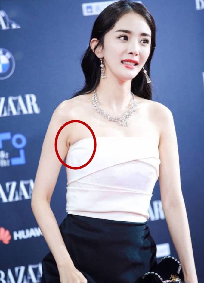 腋下脂肪堆积的副乳怎么去除,消除副乳手臂赘肉