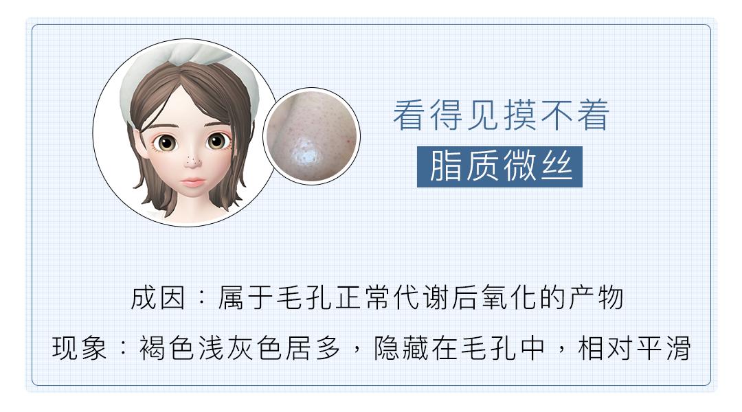 黑头痘印怎么去除,黑头痘印怎么消除学生党