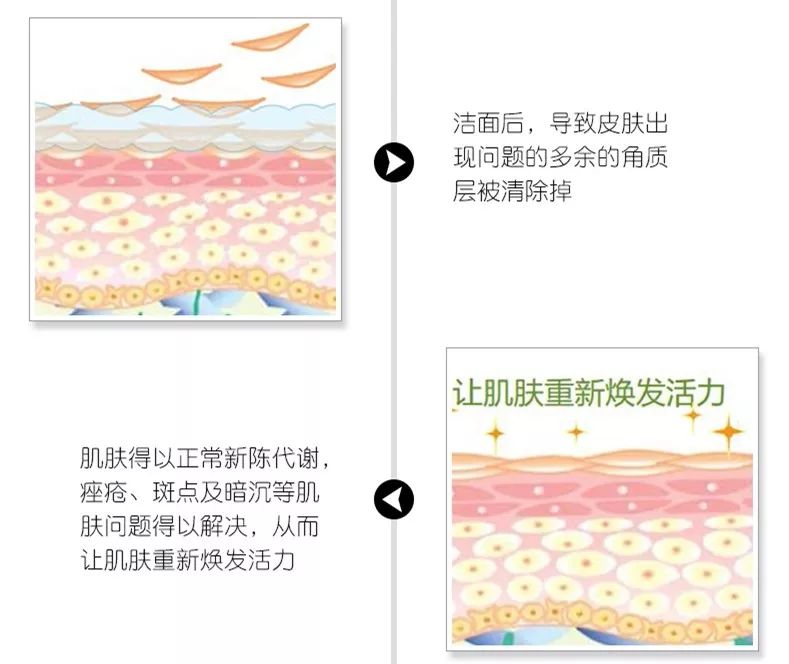 珊苏丽祛痘洁面皂,姗苏丽果酸洁面皂