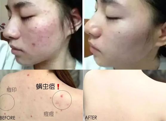 央视曝光蚕丝被长期盖,长期盖蚕丝被的危害图片