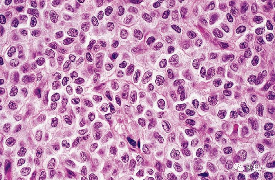 复习这些名解时总觉得怪饿的|协和八·脑洞大开