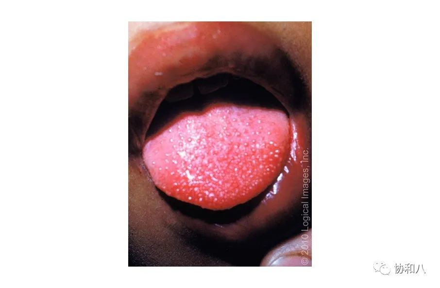 复习这些名解时总觉得怪饿的|协和八·脑洞大开