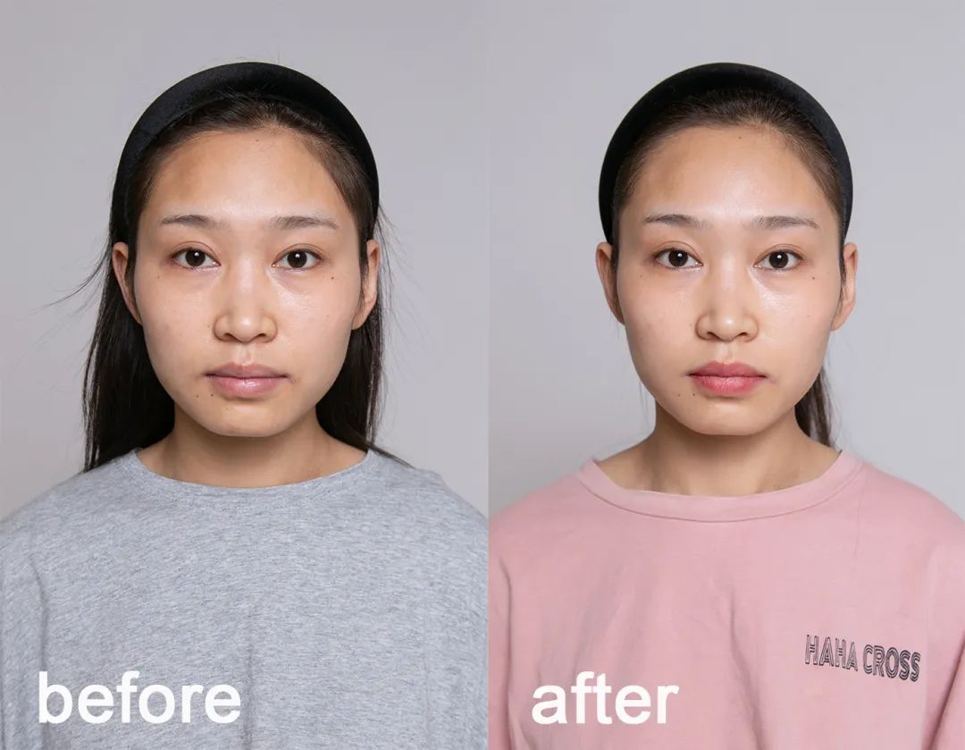 美白淡斑10天见效果,祛黄淡斑美白精华推荐