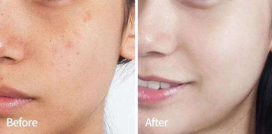 各类肌肤的实用美白技巧,美白牛奶肌的秘密在这里