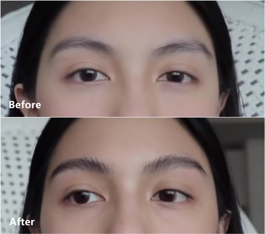 不用整容也能变漂亮的方法,五官变美的方法女生必看