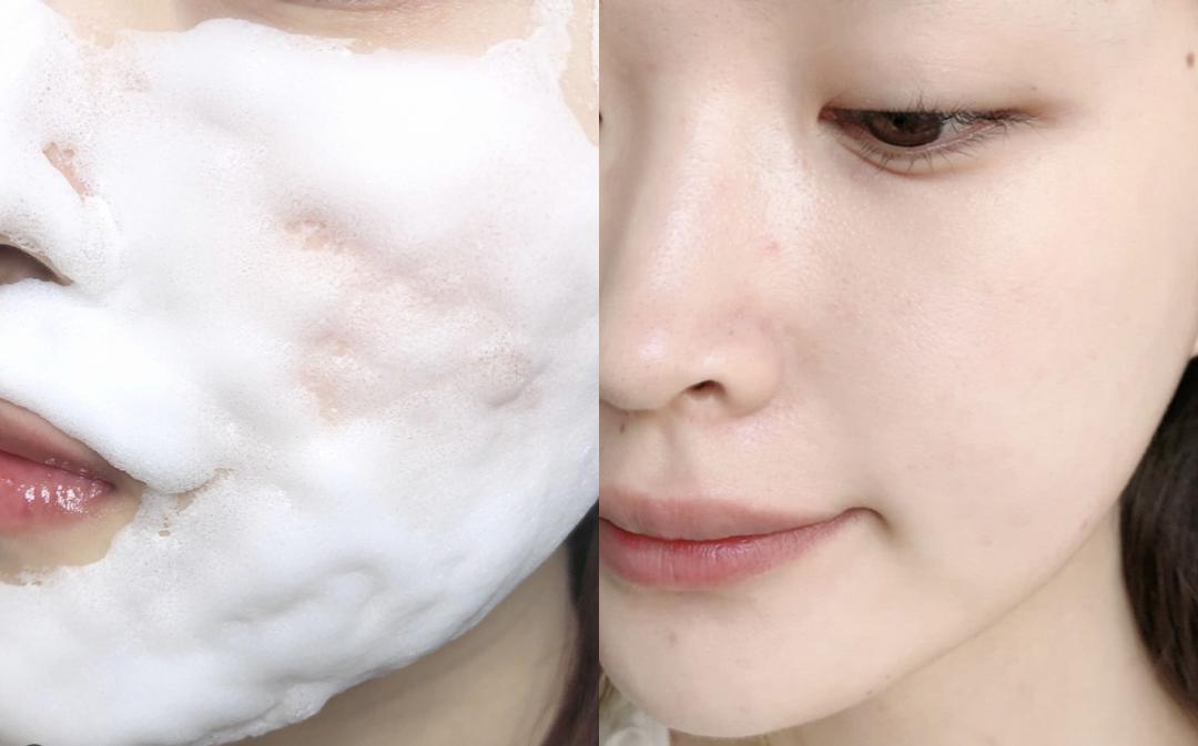 洗出脸上的脏东西解压,清除脸上斑块的产品