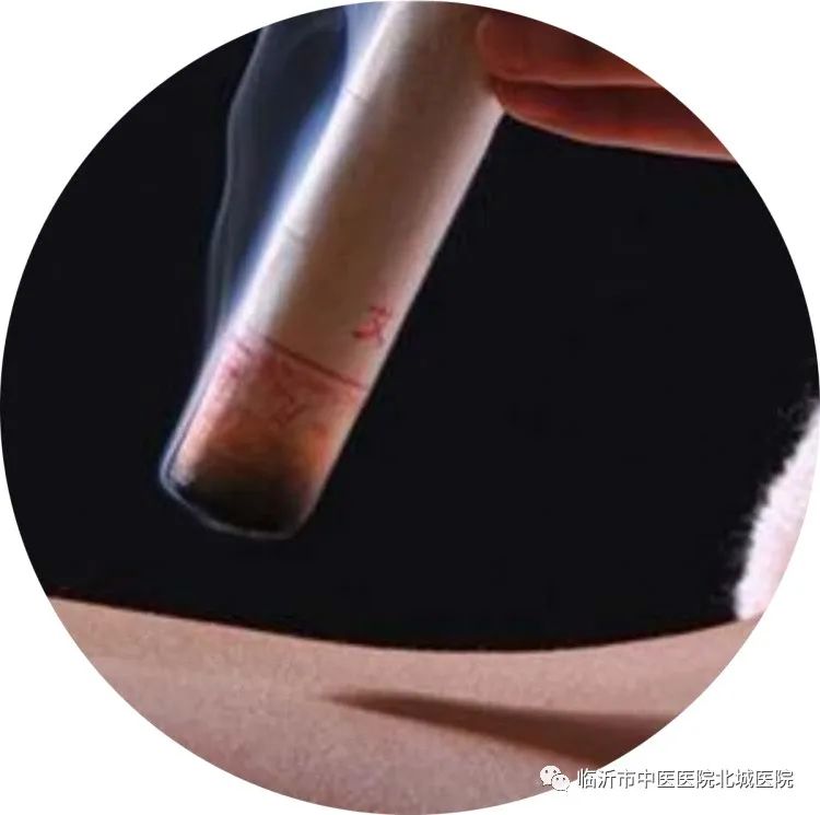 不用住院，医保报销！临沂这家医院的“中医日间病房”太赞了