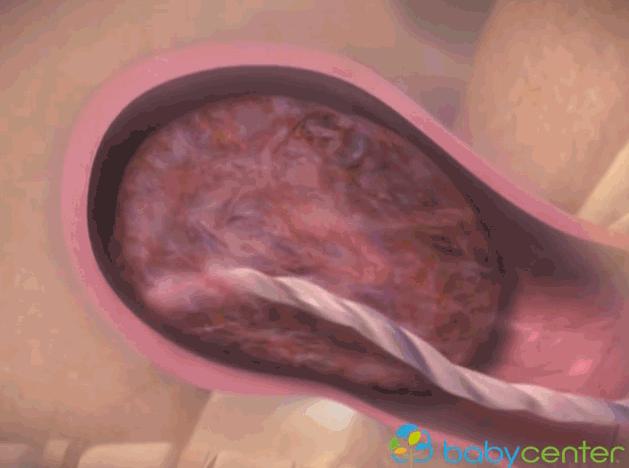 婴儿出生全过程3d演示,宝宝出生全过程纪录片