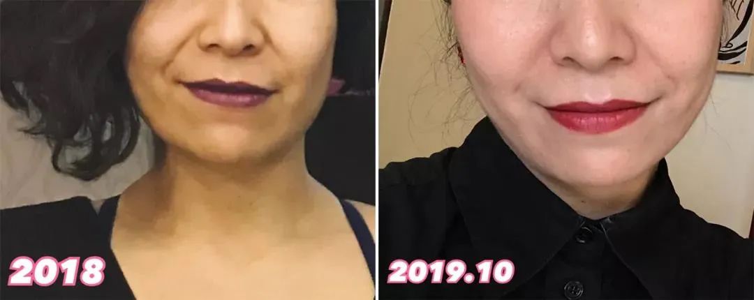 推广一个月没有任何效果,美容院脸部抗衰提拉紧致手法